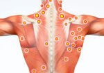 Trigger-Points-CROPPED-1024x706-1